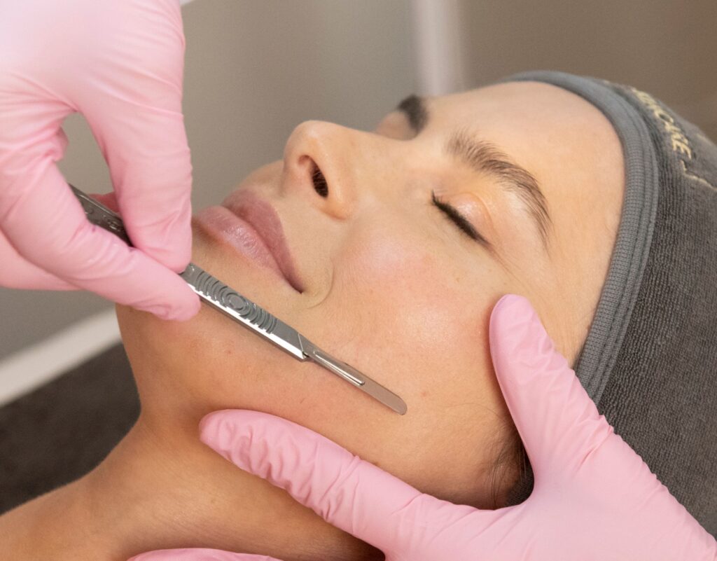 Dermaplaning